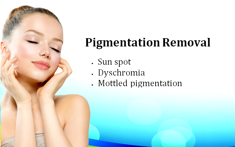 Pigmentation Removal