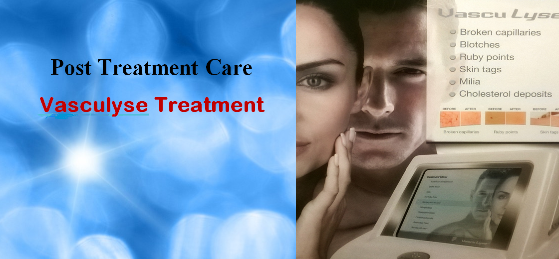 Post Treatment Care- Vasculyse